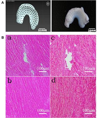 Short-term transplantation effect of a tissue-engineered meniscus constructed using drilled allogeneic acellular meniscus and BMSCs